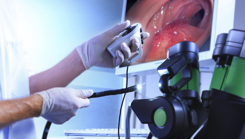 віртуальна колоноскопія