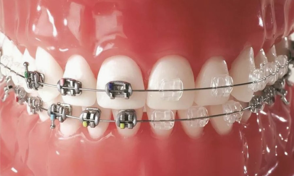 brillant.dental brillant dental